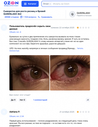 Queenlash отзывы: что стоит за обещаниями длинных ресниц